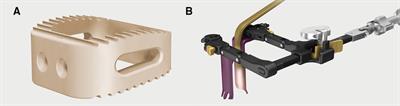 Stand-alone anterior cervical decompression and fusion surgery: A cohort study evaluating a shaped cage without plates or screws